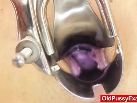 Matured gyno in addition to a super smoking-hot brunette